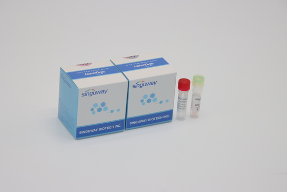 Ilościowy zestaw do wykrywania fluorescencyjnego PCR IVD dla wszystkich mutacji wirusa koronowego