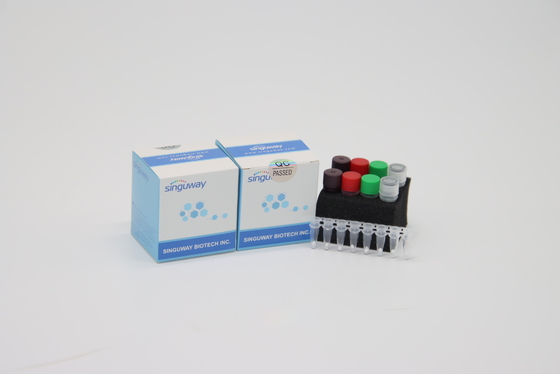 High Precision HIV Czas rzeczywisty PCR Zestaw POCT IVD Clinical Czas rzeczywisty PCR Diagnostyczny Zestaws
