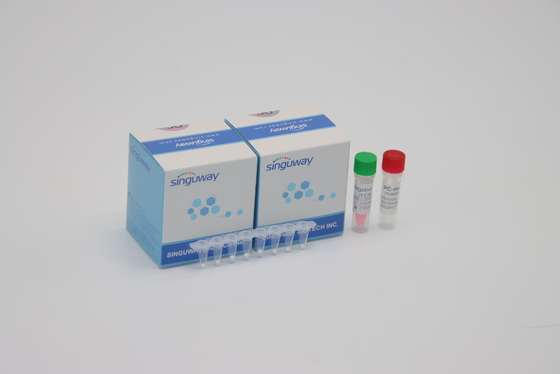 HIV Virus Virus Quantitative Fluorescent PCR Wykrycie Zestaw POCT Czas rzeczywisty CE